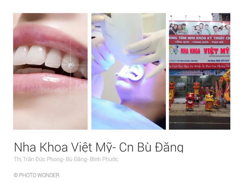 Hình ảnh nha khoa việt mỹ