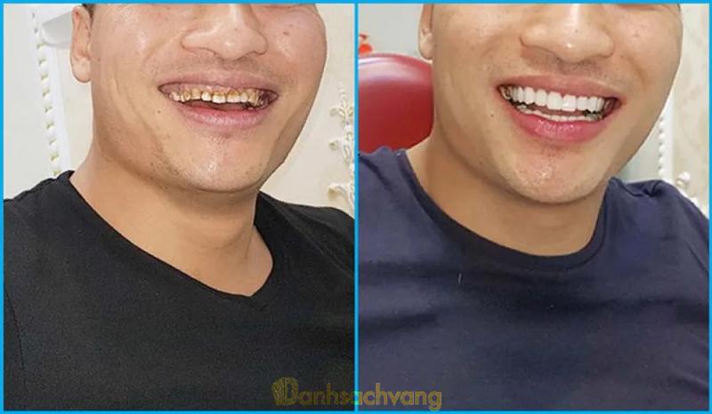 Hình ảnh nha khoa sài gòn bom bo