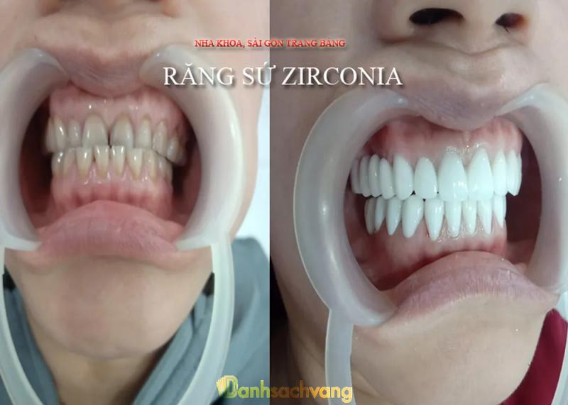 Hình ảnh Nha Khoa Sài Gòn Trảng Bàng: 226 QL22, H.Trảng Bàng