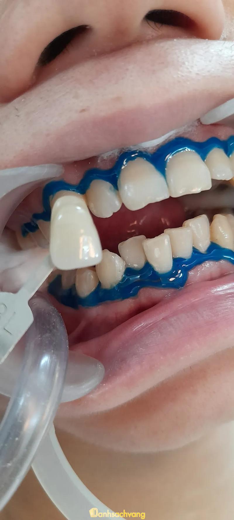 Hình ảnh NHA KHOA AN BÌNH:  Suối Sâu, H. Trảng Bàng