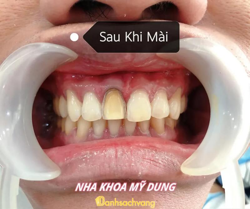 Hình ảnh Nha khoa Mỹ Dung: 180 Hùng Vương, TT. Hòa Thành, Tây Ninh