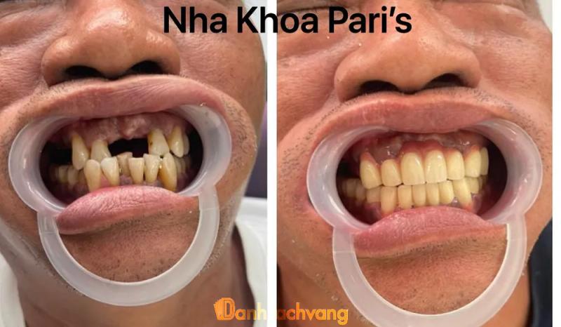 Hình ảnh Nha khoa Pari's: 28 QL22, H.Trảng Bàng