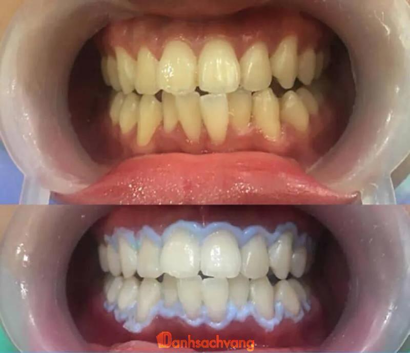 Hình ảnh Nha Khoa Tâm An: 191 QL22, H.Trảng Bàng