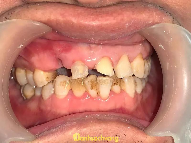 Hình ảnh Nha Khoa Bảo An: QL22B Ấp Thanh Tân , H. Tân Biên 