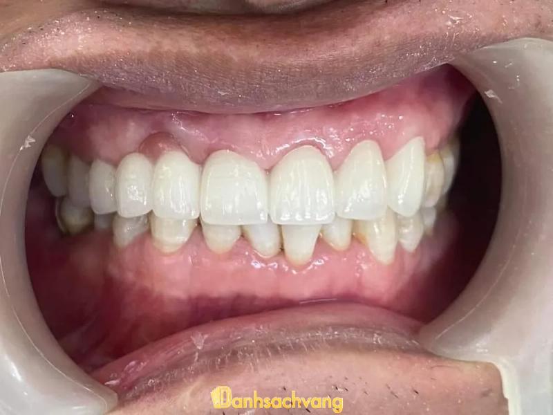 Hình ảnh Nha Khoa Bảo An: QL22B Ấp Thanh Tân , H. Tân Biên 