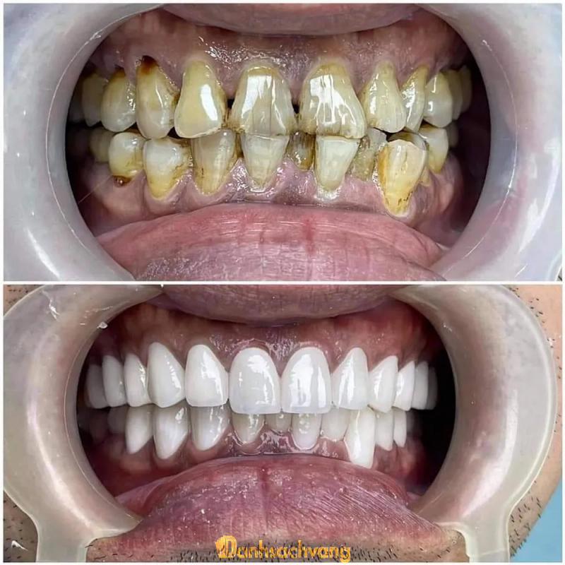 Hình ảnh Nha Khoa Bảo An: QL22B Ấp Thanh Tân , H. Tân Biên 