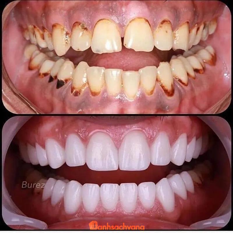 Hình ảnh Nha Khoa Bảo An: QL22B Ấp Thanh Tân , H. Tân Biên 