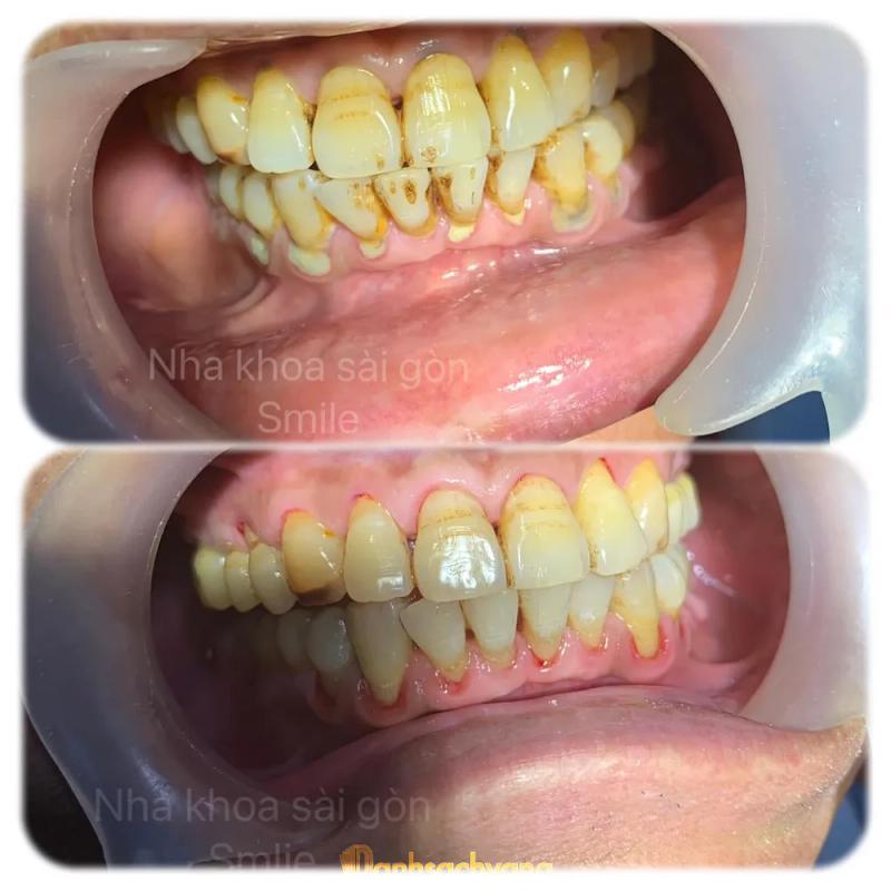 Hình ảnh nha-khoa-sai-gon-smile-251-nguyen-hue-binh-long-4