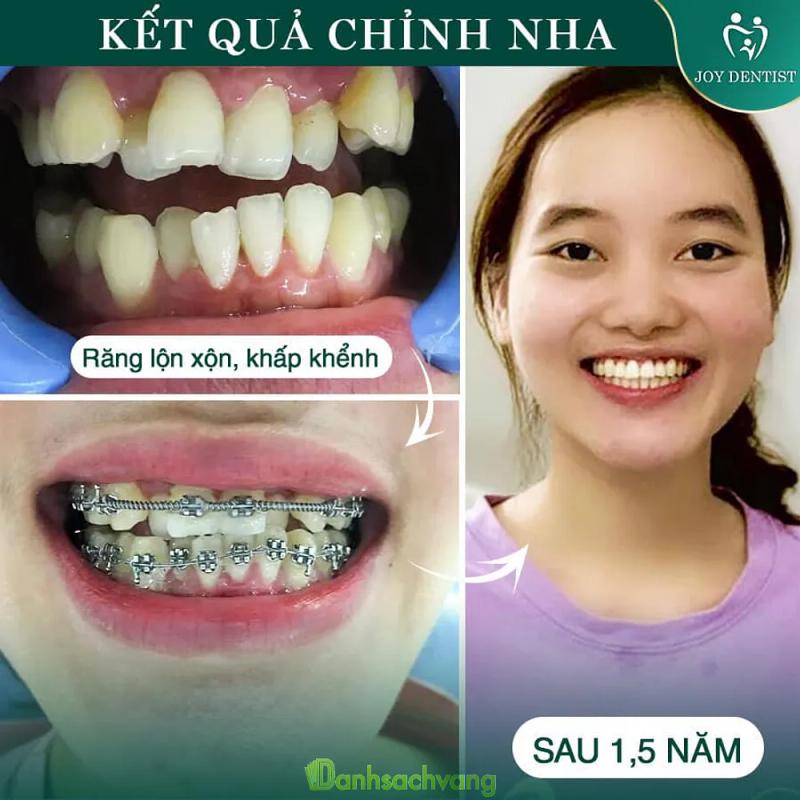 Hình ảnh Nha khoa Joy: 29 Văn Cao, Ba Đình, Hà Nội