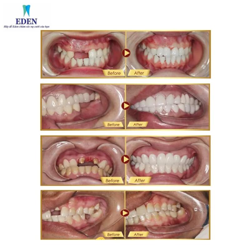 Hình ảnh Nha Khoa Eden: 74 Đào Tấn,  Ba Đình, Hà Nội