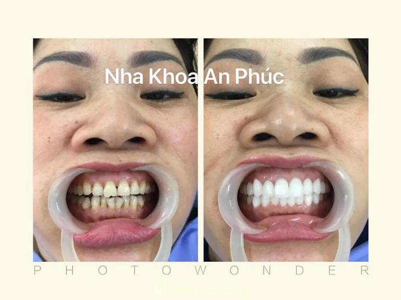 Hình ảnh Nha khoa An Phúc: 246 Thụy Khuê, Ba Đình, Hà Nội