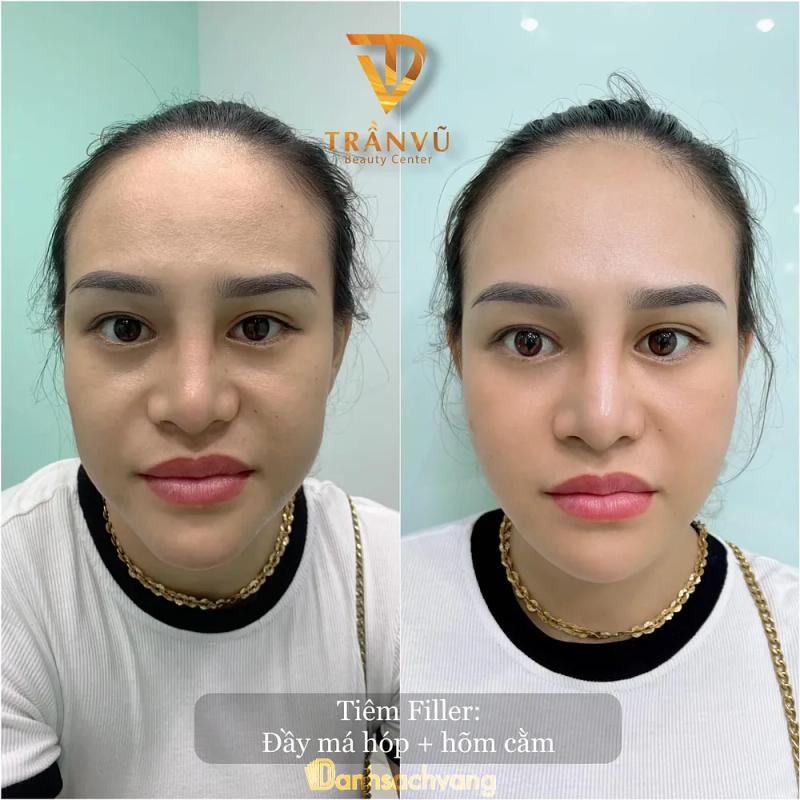Hình ảnh tham-my-tran-vu-47-dien-bien-phu-thanh-khe-3