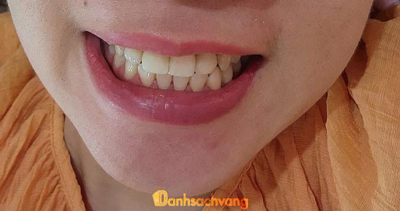 Hình ảnh Nha khoa Anh Đào: 54 Lê Duẩn, Hoàn Kiếm, Hà Nội