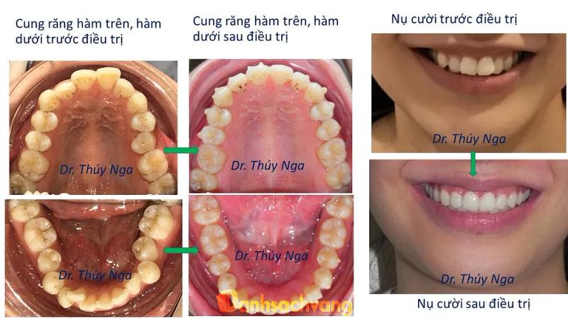 Hình ảnh Nha khoa Ami: 34 Nam Ngư, Hoàn Kiếm, Hà Nội