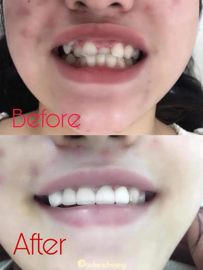 Hình ảnh Nha khoa My Smile: Ấp Thạnh Hưng,H. Tân Châu