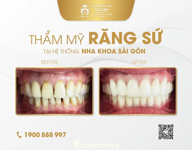 Hình ảnh nha-khoa-sai-gon-105-tran-hung-dao-soc-trang-2