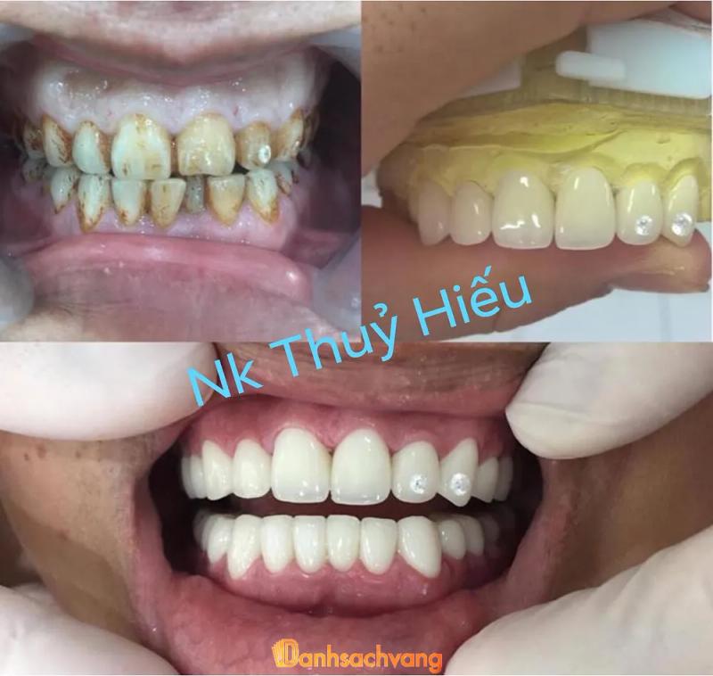 Hình ảnh Nha khoa Thủy Hiếu: 45 Thiên Hiền, Nam Từ Liêm, Hà Nội