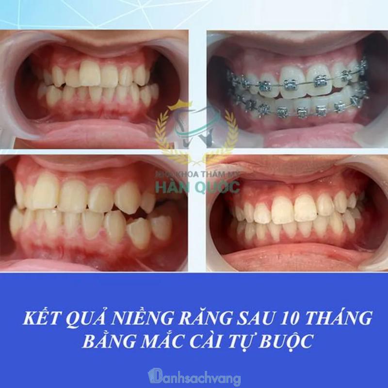 Hình ảnh Nha khoa thẩm mỹ Hàn Quốc: Toà CT1 Mỹ Đình Sông Đà, Nam Từ Liêm, Hà Nội