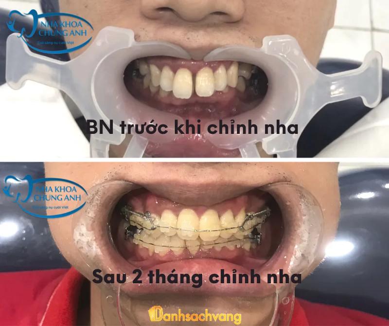 Hình ảnh Nha khoa Chung Anh: 108 Ngọc Lâm, Long Biên, Hà Nội