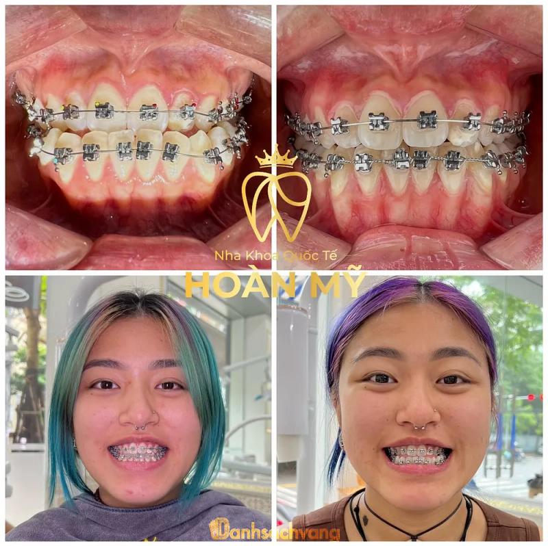 Hình ảnh Nha khoa quốc tế Hoàn Mỹ: Hà Cầu, Hà Đông, Hà Nội