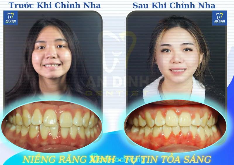 Hình ảnh Nha khoa Đại Nam An Nhơn: 234 Trần Phú, H. An Nhơn
