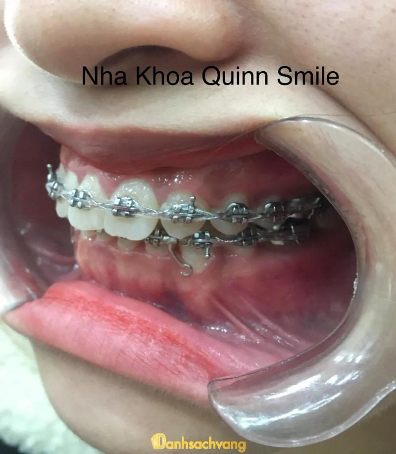 Hình ảnh Nha khoa Quinn Smile: 217 Trần Phú, Hà Đông, Hà Nội