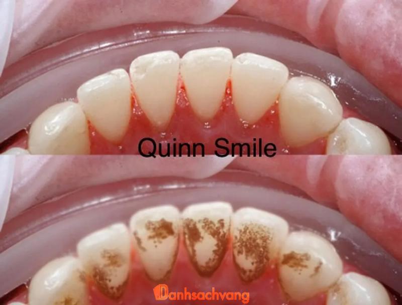 Hình ảnh Nha khoa Quinn Smile: 217 Trần Phú, Hà Đông, Hà Nội