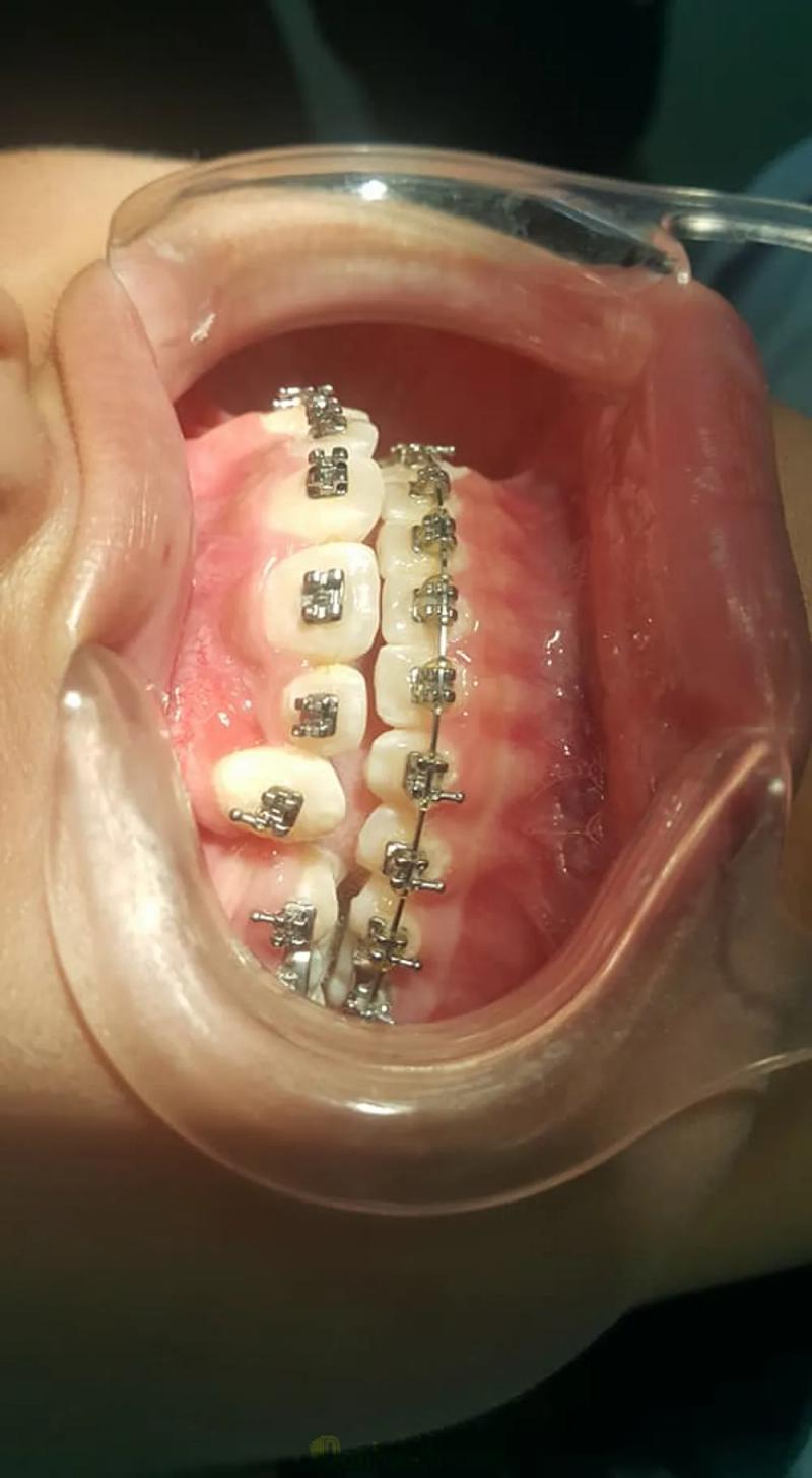 Hình ảnh Nha Khoa Trịnh: 46 Trần Phú, Hà Đông, Hà Nội