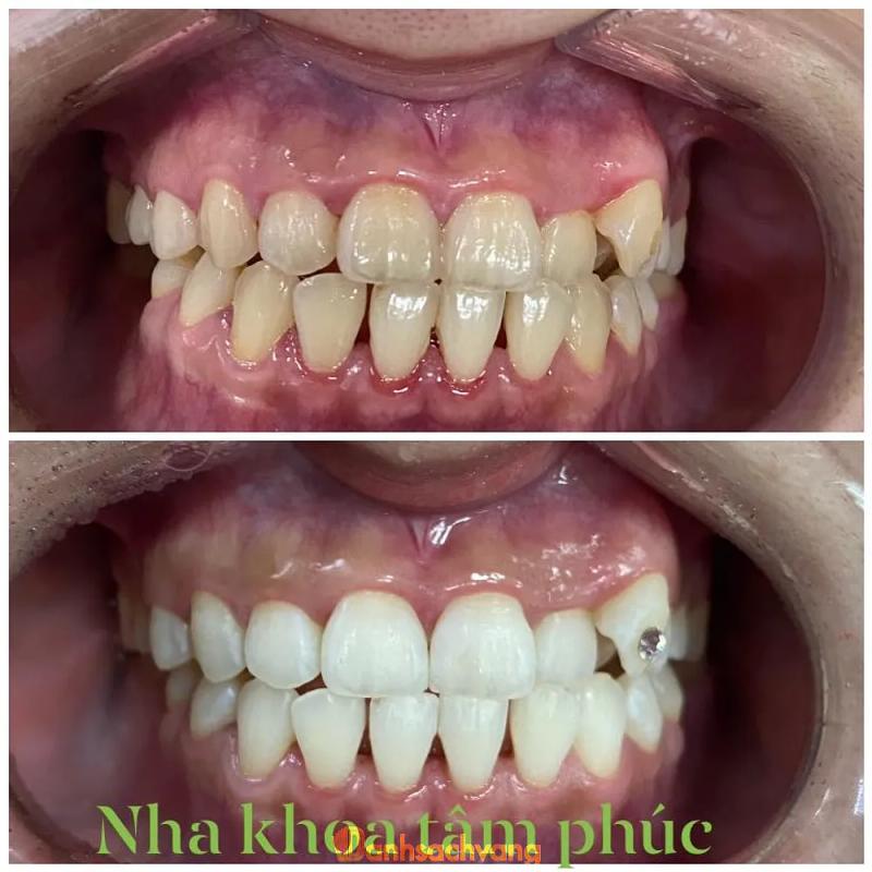 Hình ảnh Nha khoa Tâm Phúc: 18 Lê Hồng Phong, H. An Nhơn