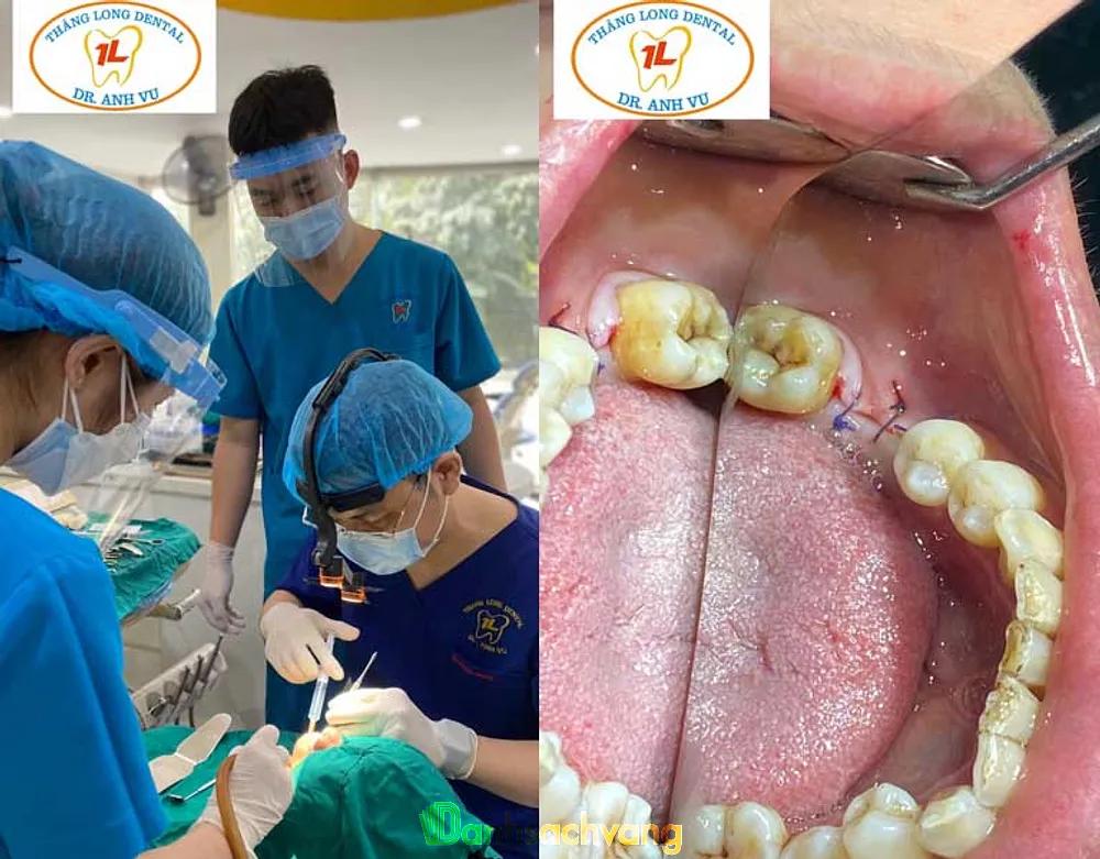 Hình ảnh Thăng Long Dental: Số 86 Phan Đình Phùng, Đan Phượng, Hà Nội