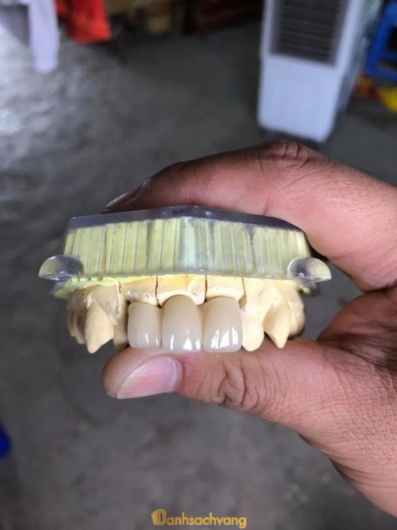 Hình ảnh Nha Khoa Huy Oanh: Vân Phúc, Phúc Thọ, Hà Nội