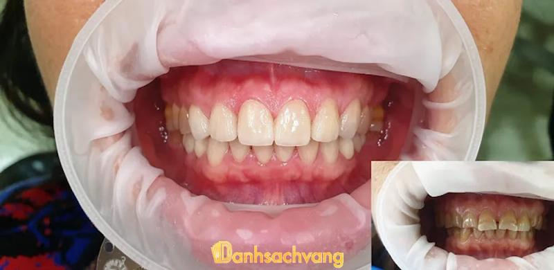 Hình ảnh Nha Khoa Huy Oanh: Vân Phúc, Phúc Thọ, Hà Nội
