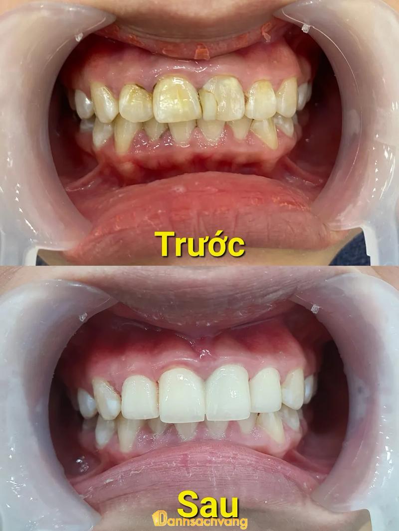 Hình ảnh Nha Khoa Thẩm Mỹ Á Đông: 90 Quang Trung, H. An Nhơn