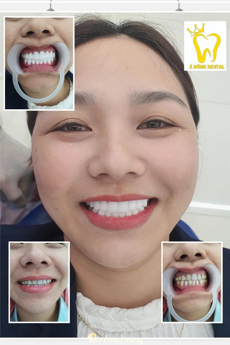 Hình ảnh Nha Khoa Thẩm Mỹ Á Đông: 90 Quang Trung, H. An Nhơn
