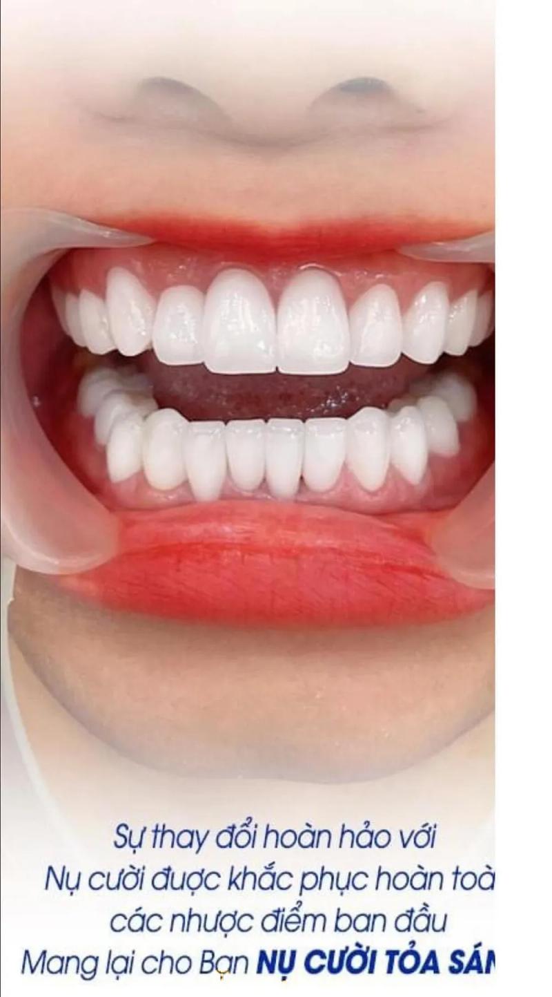 Hình ảnh Nha khoa An Sinh: 401 Hồng Lĩnh, H. An Nhơn