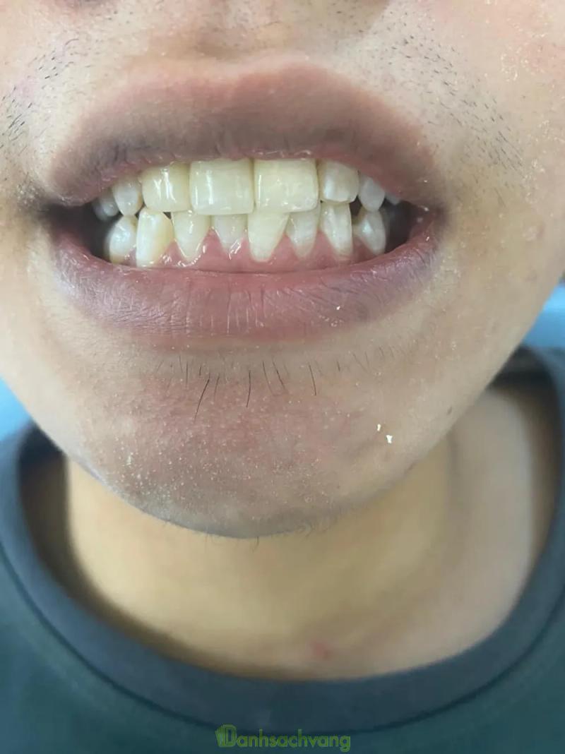 Hình ảnh Nha khoa An Sinh: 401 Hồng Lĩnh, H. An Nhơn