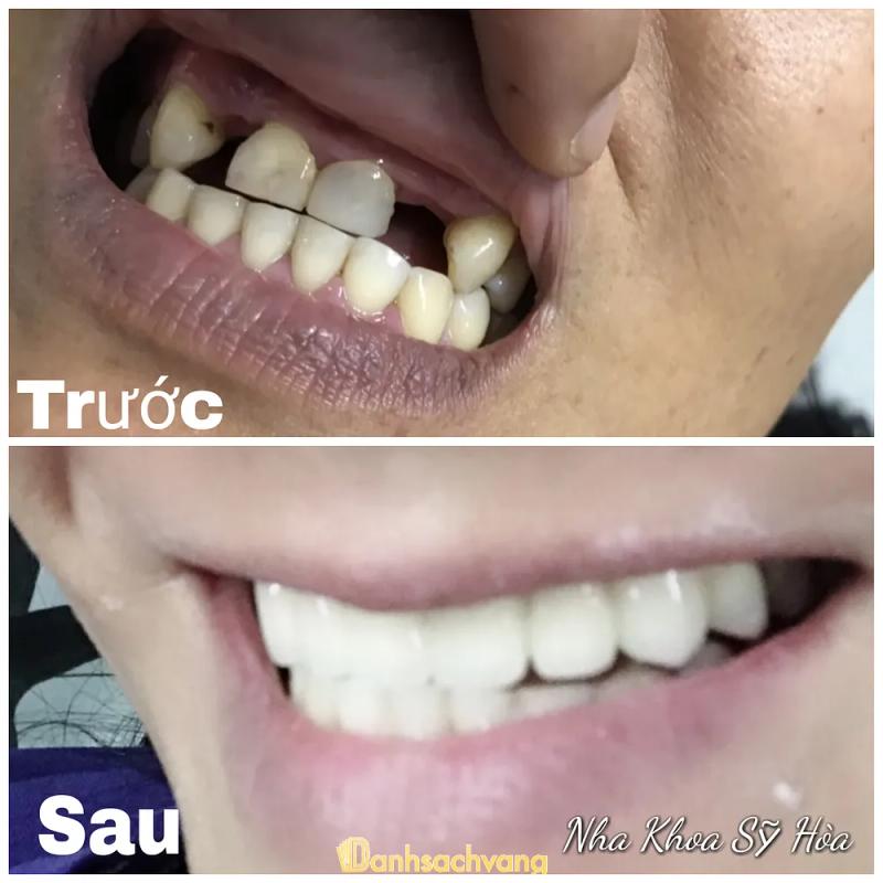 Hình ảnh Nha Khoa Sỹ Hòa: 16D Ba Tháng Hai,  H. Phù Cát