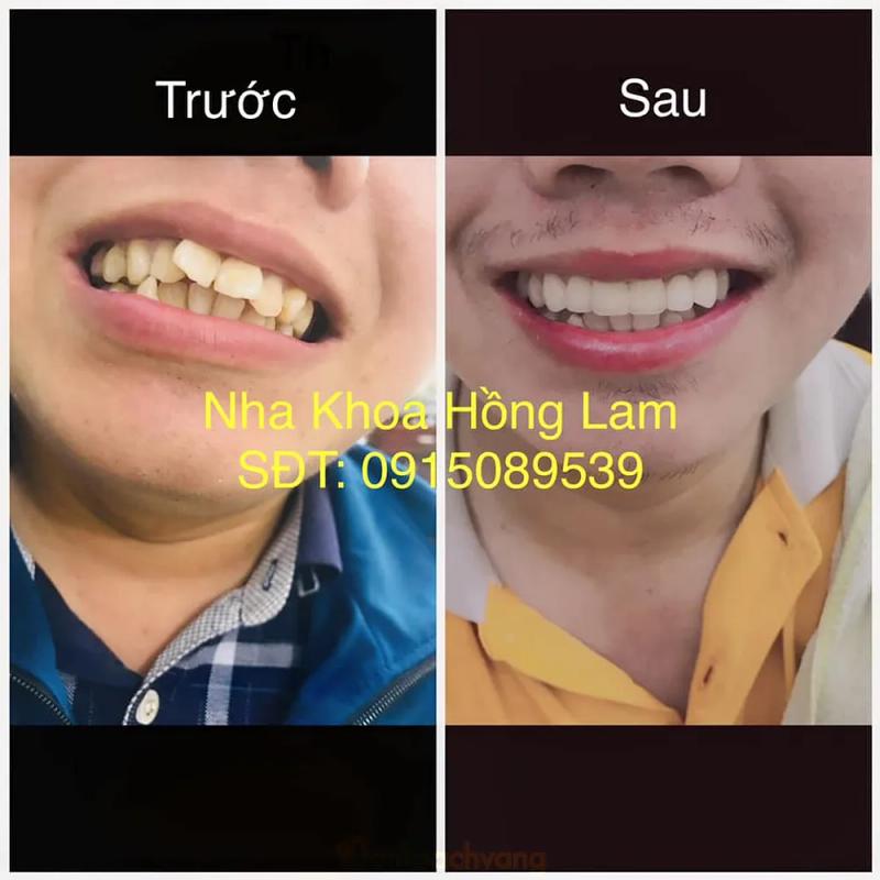 Hình ảnh Nha Khoa Hồng Lam: 296 Nguyễn Du, TP.Hà Tĩnh