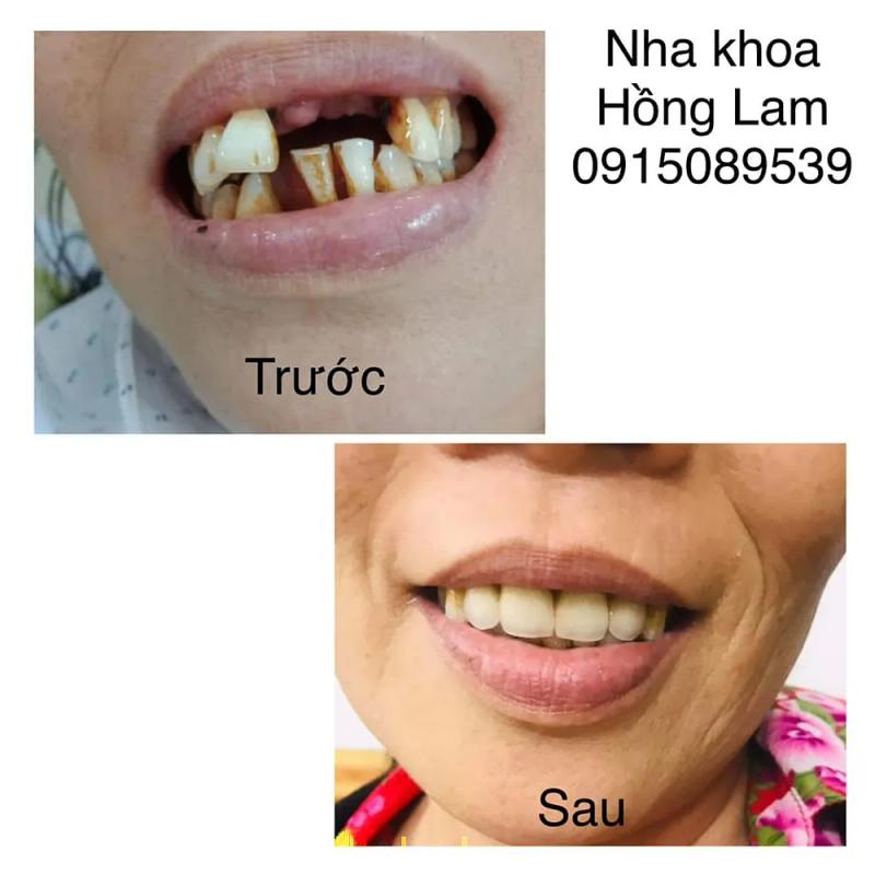Hình ảnh Nha Khoa Hồng Lam: 296 Nguyễn Du, TP.Hà Tĩnh