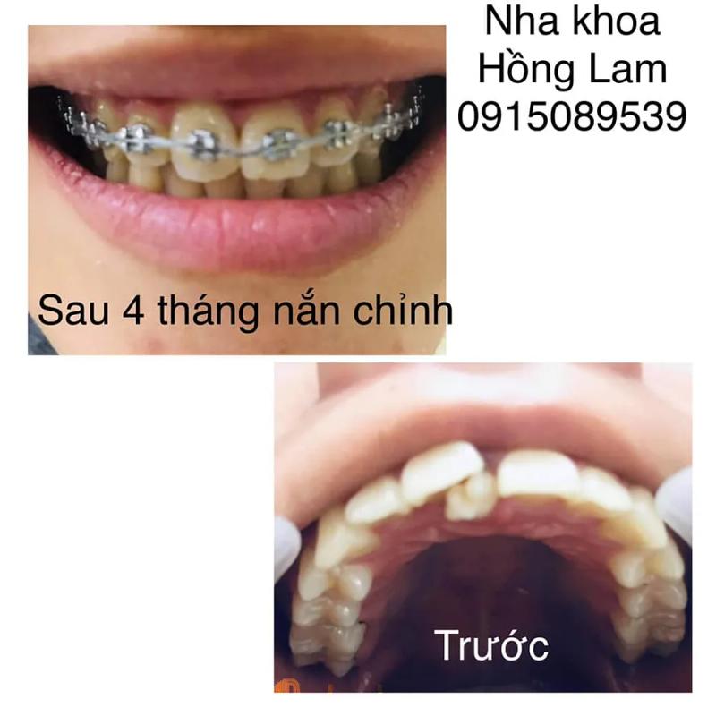 Hình ảnh Nha Khoa Hồng Lam: 296 Nguyễn Du, TP.Hà Tĩnh