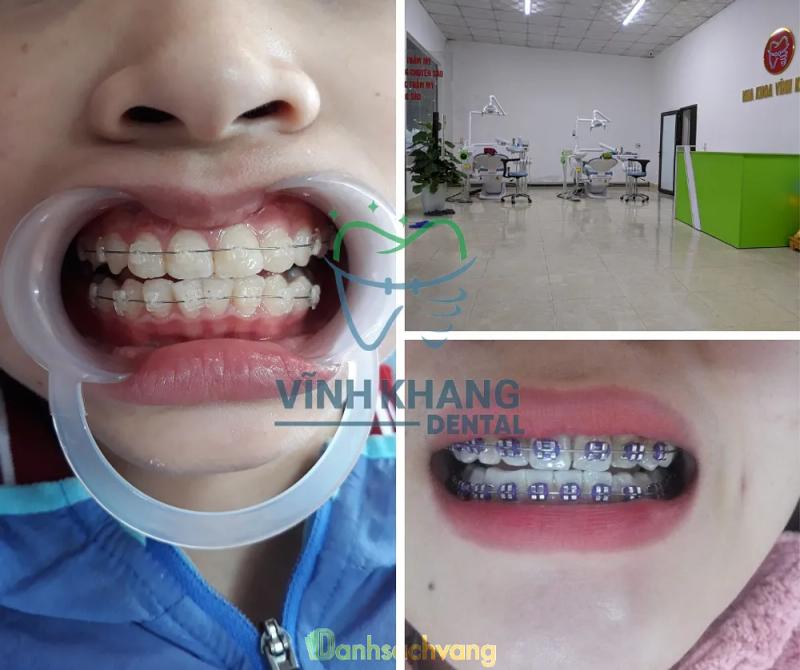 Hình ảnh Nha Khoa Vĩnh Khang:  699 Đ. Lê Đại Hành, TT. Kỳ Anh, Kỳ Anh, Hà Tĩnh