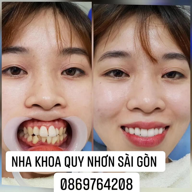 Hình ảnh Nha Khoa Quy Nhơn - Sài Gòn: 317 Đào Tấn, H. Tuy Phước,