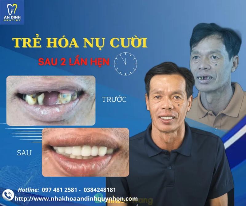 Hình ảnh Nha Khoa An Định 2: 254 Trần Phú, H. Tuy Phước