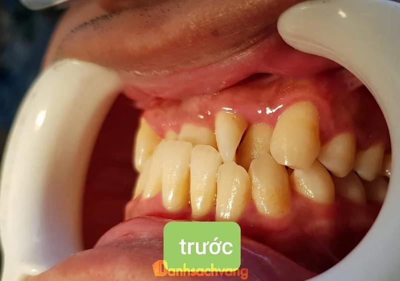 Hình ảnh nha-khoa-cuong-viet-906-le-loi-tp-bac-giang-2