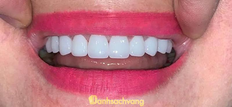 Hình ảnh Nha Khoa Phụng Hiệp: 44 Lê Lợi , TP. Ngã Bảy
