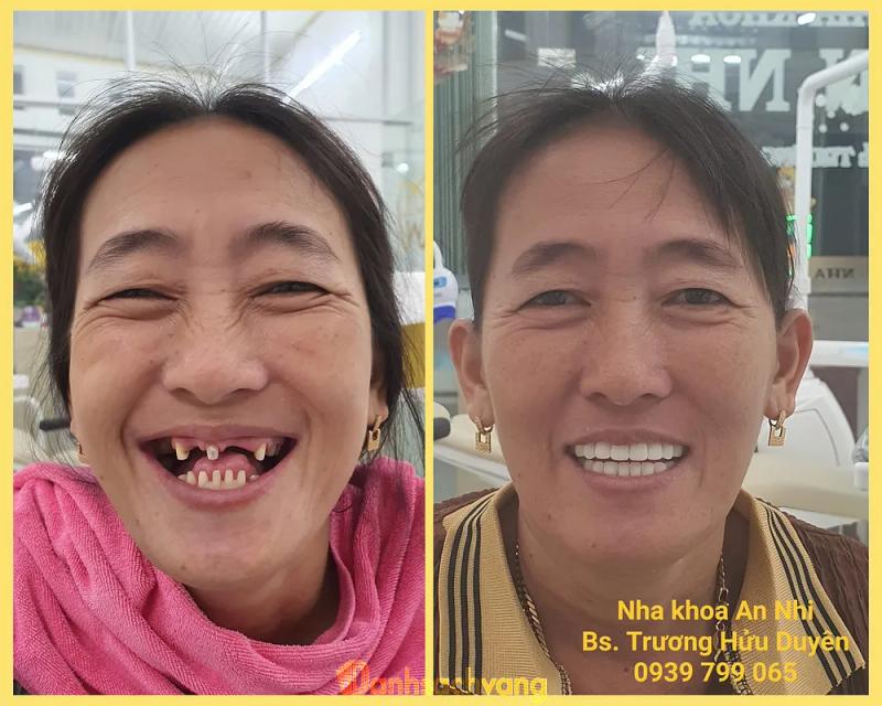 Hình ảnh Nha khoa An Nhi: 116 Nguyễn Trãi, TP. Ngã Bảy