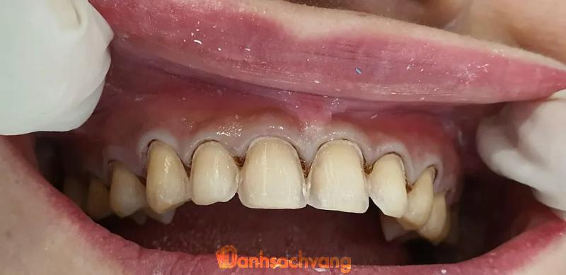 Hình ảnh Nha Khoa Việt Hàn: Thượng Đức, Bố Trạch, Quảng Bình