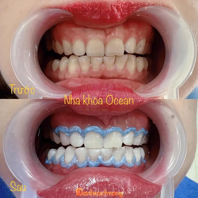 Hình ảnh Nha khoa Ocean: 91 Trần Hưng Đạo, Tp. Lào Cai