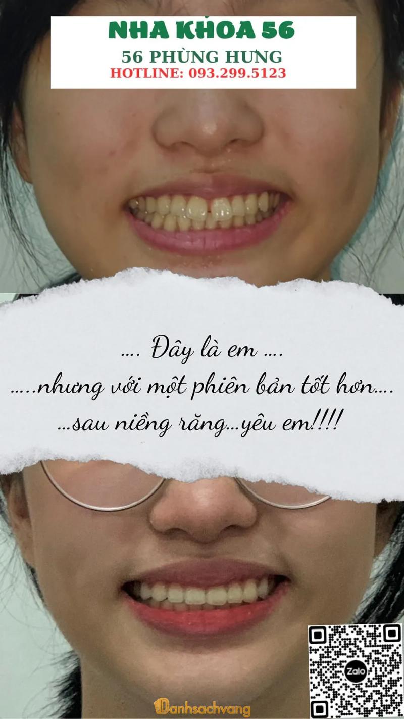 Hình ảnh Nha Khoa 56: 56 Phùng Hưng, Tp Huế, Thừa Thiên Huế