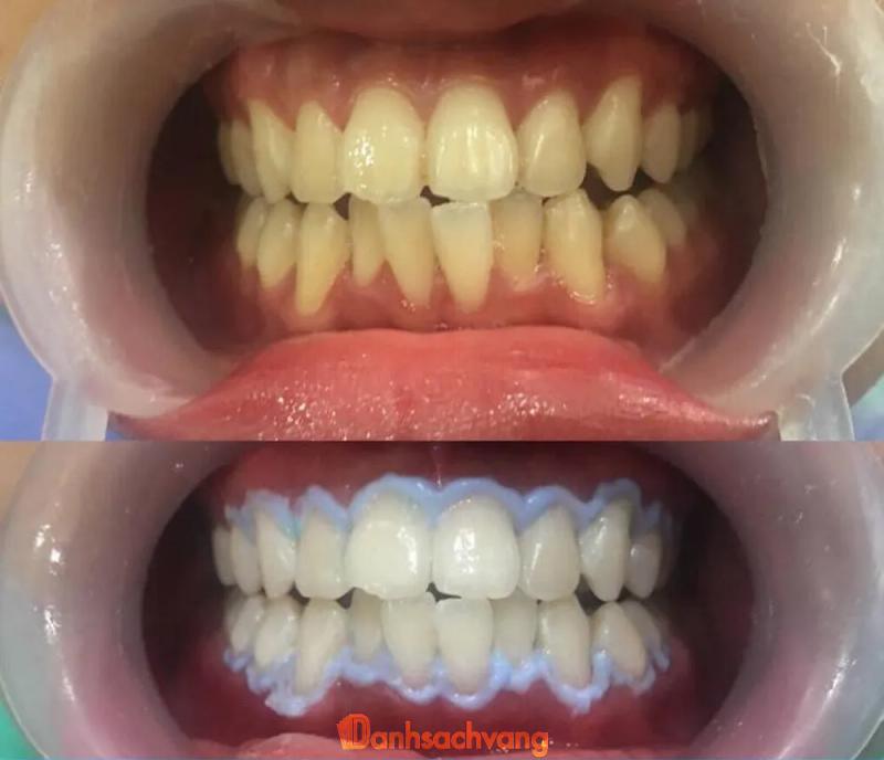 Hình ảnh Nha Khoa Hằng Hùng: 280 Điện Biên Phủ, TP. Lai Châu